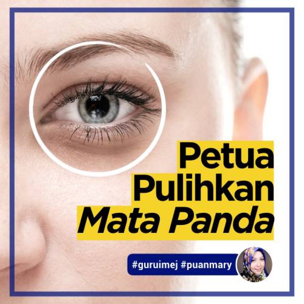 Cara Menghilangkan Mata Panda Puan Mary